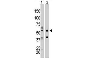 The EIF2AK2 polyclonal antibody  is used in Western blot to detect EIF2AK2 in mouse liver tissue lysate (Lane 1) and HepG2 cell lysate (Lane 2) . (EIF2AK2 Antikörper  (N-Term))