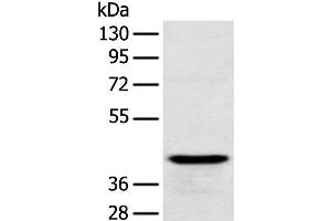 Western blot analysis of Human testis tissue using RSPH1 Polyclonal Antibody at dilution of 1:250 (RSPH1 Antikörper)