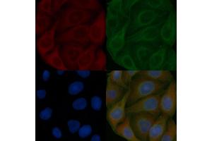 TFG Mouse Monoclonal Antibody staining Hela cells by IF/ICC. (TFG Antikörper)