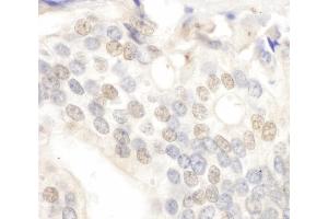 Immunohistochemistry (IHC) image for anti-E2F Transcription Factor 4, P107/p130-Binding (E2F4) (AA 363-413) antibody (ABIN7448538)