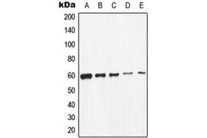 Western blot analysis of c-SRC expression in K562 (A), HeLa (B), MCF7 (C), HepG2 (D), mouse primary astrocytes (E) whole cell lysates. (Src Antikörper  (C-Term))