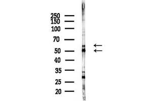 anti-AKT1/3 antibody