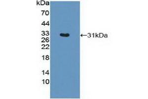 Western blot analysis of recombinant Mouse MHCDRb1. (HLA-DRB1 Antikörper  (AA 27-264))