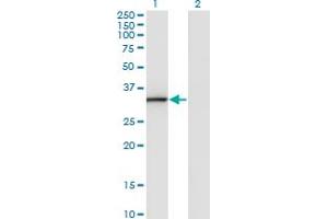 Western Blot analysis of ANXA3 expression in transfected 293T cell line by ANXA3 monoclonal antibody (M07), clone 1E2.