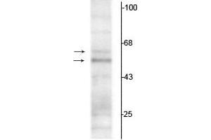Western blot of rat hippocampal lysate showing specific immunolabeling of the ~50 kDa TR-α1 and the ~58 kDa TR-α2 protein. (THRA Antikörper  (N-Term))