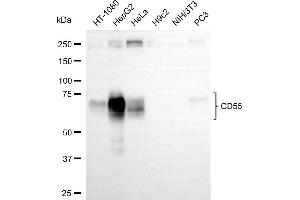 Western blotting analysis using CD55 antibody (ABIN7798142).