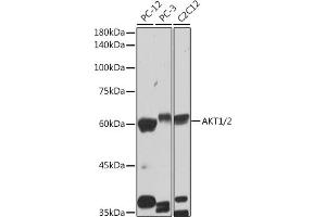 Western blot analysis of extracts of various cell lines, using /2 antibody (ABIN1679270, ABIN1679271, ABIN7101491 and ABIN7101492) at 1:1000 dilution. (AKT1/2 Antikörper)