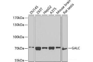 Western blot analysis of extracts of various cell lines using GALC Polyclonal Antibody at dilution of 1:1000. (GALC Antikörper)