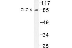 Image no. 1 for anti-Chloride Channel 4 (CLCN4) antibody (ABIN317826)