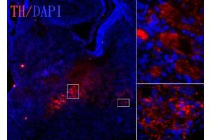 IHC-Fr Image Tyrosine hydroxylase antibody [N1C1] detects tyrosine hydroxylase protein on embryonic mouse brain by immunohistochemical analysis.