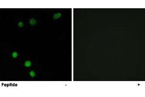 Immunofluorescence analysis of MCF-7 cells, using TP53INP2 polyclonal antibody . (TP53INP2 Antikörper)