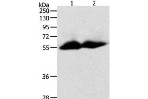 Western Blot analysis of Human colon and ovarian cancer tissue using MMP11 Polyclonal Antibody at dilution of 1:600 (MMP11 Antikörper)