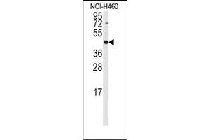 Image no. 1 for anti-Required For Meiotic Nuclear Division 5 Homolog B (RMND5B) (C-Term) antibody (ABIN357964) (RMND5B Antikörper  (C-Term))