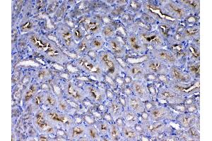 Immunohistochemistry (IHC) image for anti-Insulin-Like Growth Factor 1 Receptor (IGF1R) (AA 31-257) antibody (ABIN5519001)