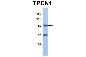 Host:  Rabbit  Target Name:  TPCN1  Sample Type:  HT1080  Antibody Dilution:  1. (TPCN1 Antikörper  (N-Term))