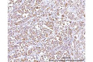 IHC analysis of RPN1 using anti-RPN1 antibody (ABIN7600447).