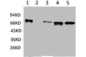 Western blot analysis of 1) Hela, 2) Jurkat, 3) Mouse Brain, 4) Mouse Kidney, 5) Rat Brain using ZBTB45 Polyclonal Antibody. (ZBTB45 Antikörper)