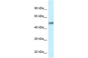 Western Blot showing CAMK2D antibody used at a concentration of 1 ug/ml against HT1080 Cell Lysate (CAMK2D Antikörper  (C-Term))