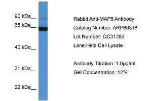 WB Suggested Anti-MAP6  Antibody Titration: 0. (MAP6 Antikörper  (N-Term))