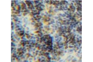 Used in DAB staining on fromalin fixed paraffin-embedded Spleen tissue (BID Antikörper  (AA 1-195))