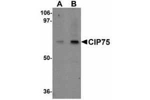 Image no. 1 for anti-Ubiquilin 4 (UBQLN4) (N-Term) antibody (ABIN478130)