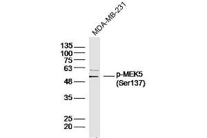 Human MDA-MB-231 cells probed with MEK5(Ser137) Polyclonal Antibody, unconjugated  at 1:300 overnight at 4°C followed by a conjugated secondary antibody at 1:10000 for 90 minutes at 37°C. (MAP2K5 Antikörper  (pSer137))