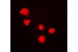 Immunofluorescent analysis of BMI1 staining in K562 cells. (BMI1 Antikörper)