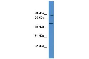 WB Suggested Anti-ZER1 Antibody Titration: 1. (ZER1 Antikörper  (Middle Region))