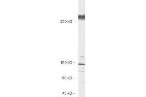 antibody dilution: 1 : 1000, sample: rat hippocampus lysate (CACNA1B Antikörper)