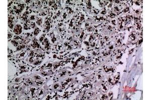 Immunohistochemistry (IHC) analysis of paraffin-embedded Human Breast, antibody was diluted at 1:100. (HSP90 Antikörper  (acLys284, acLys292))