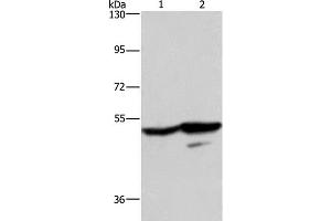 Western Blot analysis of A431 and K562 cell using GPR39 Polyclonal Antibody at dilution of 1:200 (GPR39 Antikörper)