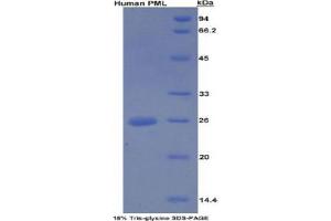 SDS-PAGE analysis of Human PML Protein. (PML Protein)