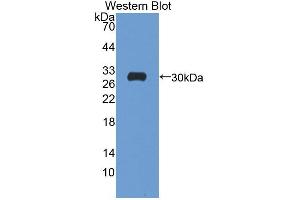 Western blot analysis of the recombinant protein. (ATP1B4 Antikörper  (AA 132-356))