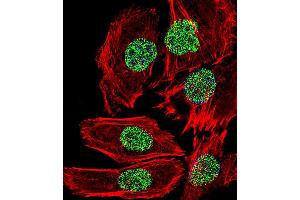 Fluorescent confocal image of A549 cell stained with FOSL2 Antibody . (FOSL2 Antikörper  (C-Term))