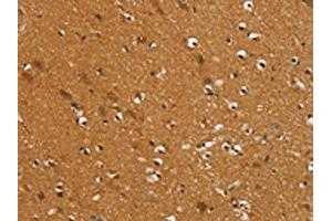 The image on the left is immunohistochemistry of paraffin-embedded Human brain tissue using ABIN7192401(SLC16A3 Antibody) at dilution 1/30, on the right is treated with synthetic peptide. (SLC16A3 Antikörper)