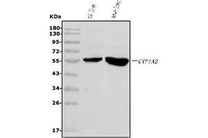 Western blot analysis of Cytochrome P450 1A2/Cyp1a2 using anti-Cytochrome P450 1A2/Cyp1a2 antibody (ABIN7600376).