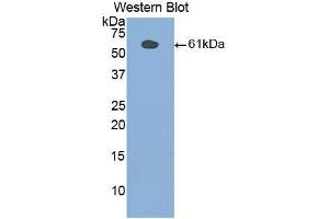 Western blot analysis of the recombinant protein. (PLAA Antikörper  (AA 534-792))