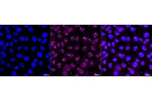 Immunocytochemical staining of HT- cells with Proteasome activator subunit 1 antibody (ABIN7799957), 1:1,000). (Rekombinanter LACBIDRAFT 301065 Antikörper  (Subunit 1))