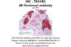 Image no. 1 for anti-Taste Receptor, Type 1, Member 3 (TAS1R3) (Extracellular Domain), (N-Term) antibody (ABIN1739917)