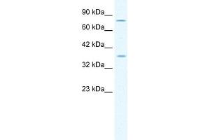 WB Suggested Anti-MCM4 Antibody Titration:  1. (MCM4 Antikörper  (Middle Region))