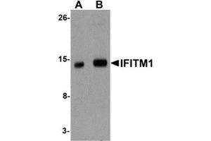 Western blot analysis of IFITM1 in 3T3 cell lysate with IFITM1 antibody at (A) 1 and (B) 2 μg/ml. (IFITM1 Antikörper  (Center))