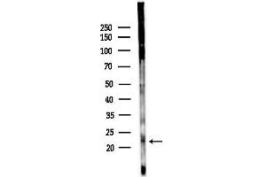 anti-Interleukin 28A (Interferon, lambda 2) (IL28A) (N-Term) antibody
