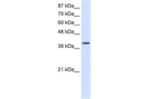 Western Blotting (WB) image for anti-Eukaryotic Translation Initiation Factor 4 gamma 2 (EIF4G2) antibody (ABIN2462107) (EIF4G2 Antikörper)
