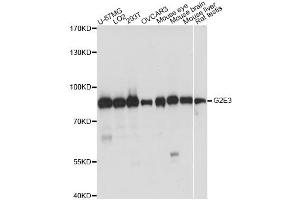 Western blot analysis of extracts of various cell lines, using G2E3 antibody. (G2E3 Antikörper)