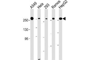 All lanes : Anti-FASN Antibody (Center) at 1:500-1:2000 dilution Lane 1: A549 whole cell lysate Lane 2: Hela whole cell lysate Lane 3: 293 whole cell lysate Lane 4: Ramos whole cell lysate Lane 5: HepG2 whole cell lysate Lysates/proteins at 20 μg per lane. (Fatty Acid Synthase Antikörper  (AA 942-973))