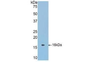 Western Blotting (WB) image for anti-serpin Peptidase Inhibitor, Clade A (Alpha-1 Antiproteinase, Antitrypsin), Member 6 (SERPINA6) (AA 268-391) antibody (ABIN7438403)