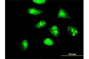 Immunofluorescence (IF) image for anti-Nucleolar Protein 16 (NOP16) (AA 1-178) antibody (ABIN526755)