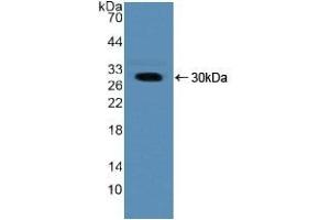 Detection of Recombinant NUP50, Human using Polyclonal Antibody to Nucleoporin 50 kDa (NUP50) (NUP50 Antikörper  (AA 37-269))