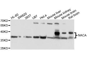 Western blot analysis of extracts of various cell lines, using NACA antibody. (NACA Antikörper  (AA 1-215))
