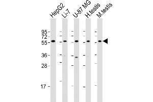 Western Blotting (WB) image for anti-7-Dehydrocholesterol Reductase (DHCR7) (AA 437-463), (C-Term) antibody (ABIN655399)